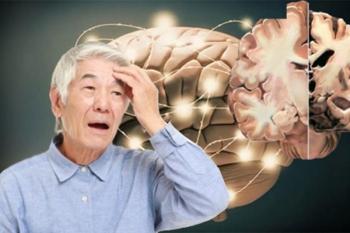 Bệnh Alzheimer là gì? Nguyên nhân, triệu chứng và cách điều trị