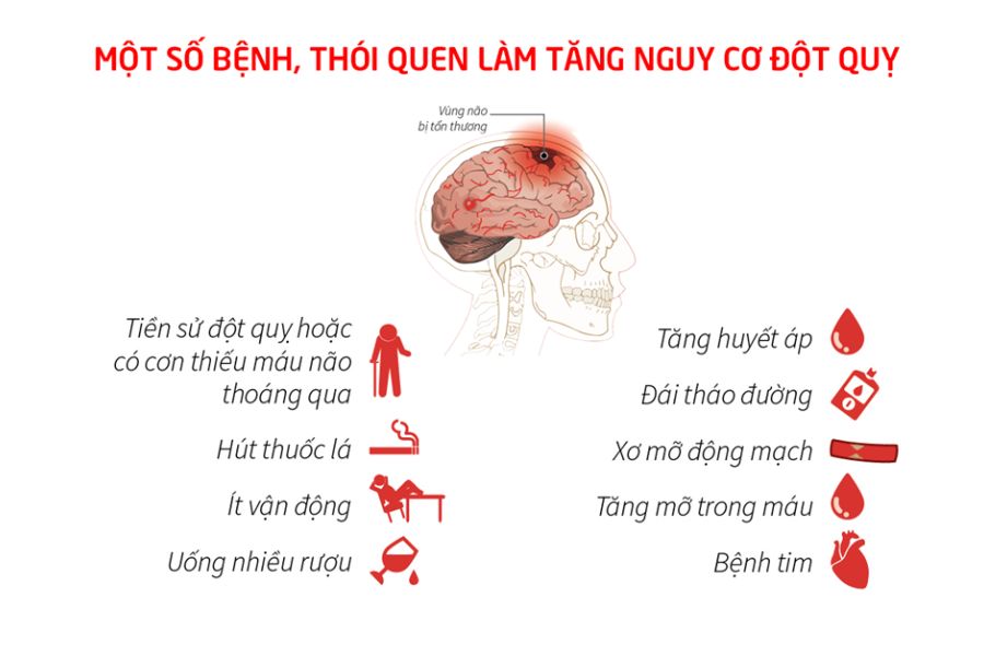 Các yếu tố nguy cơ của đột quỵ